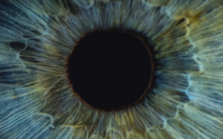 C&rsquo;est quoi, un naturopathe iridologue ?